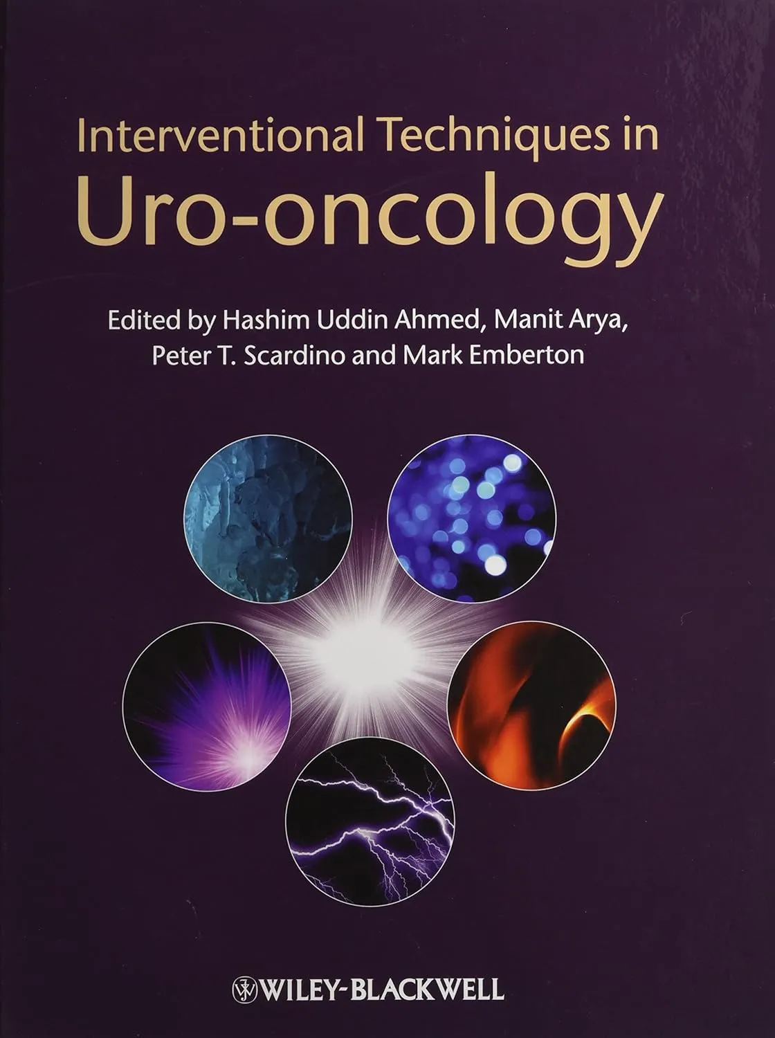 Interventional Techniques in Uro-Oncology | Hardcover