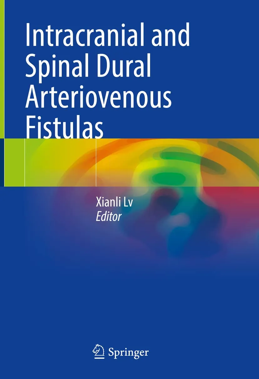 Intracranial And Spinal Dural Arteriovenous Fistulas | Hardcover