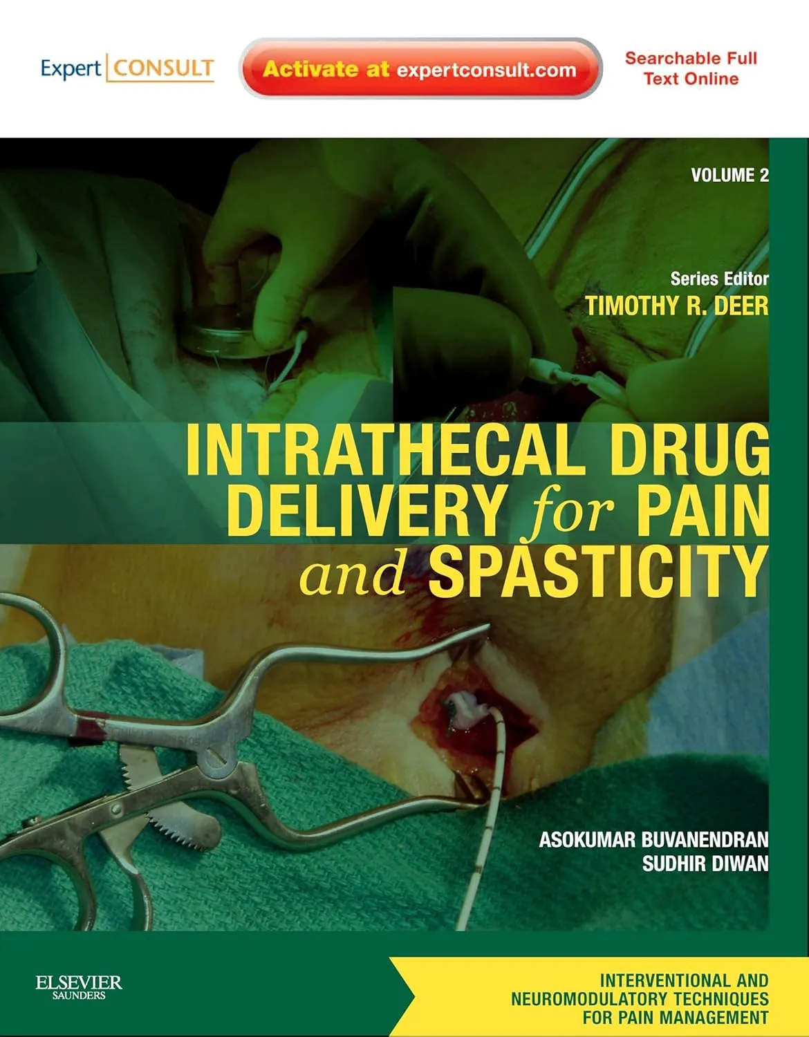 Intracthecal Drug Delivery for Pain and Spasticity | Volume 2 | Hardcover