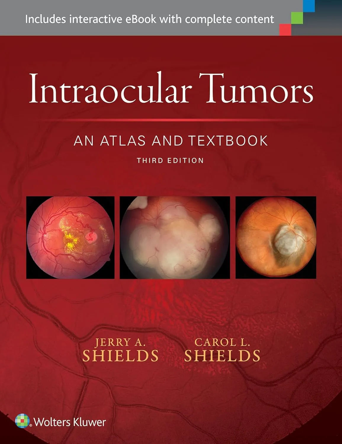 Intraocular Tumors An Atlas and Textbook | Third Edition | Hardcover
