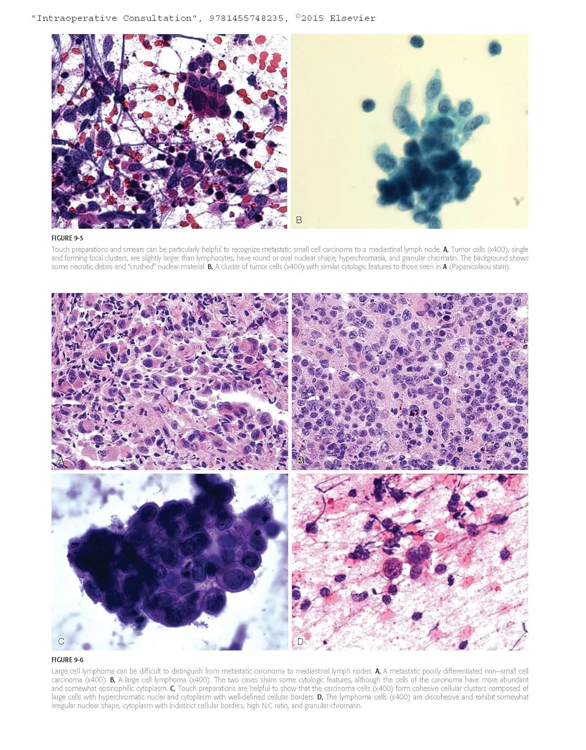 Intraoperative Consultation Foundations in Diagnostic Pathology | Hardcover