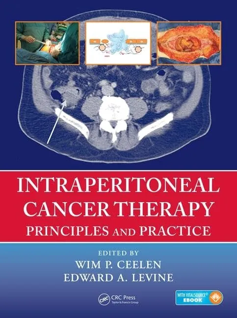 Intraperitoneal Cancer Therapy Principles and Practice | Hardcover