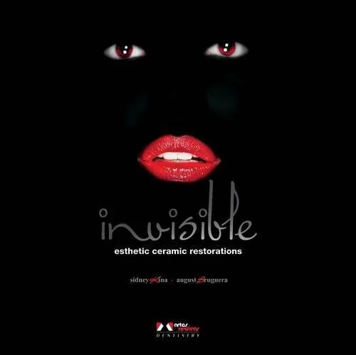 Invisible Esthetic Ceramic Restorations | Hardcover