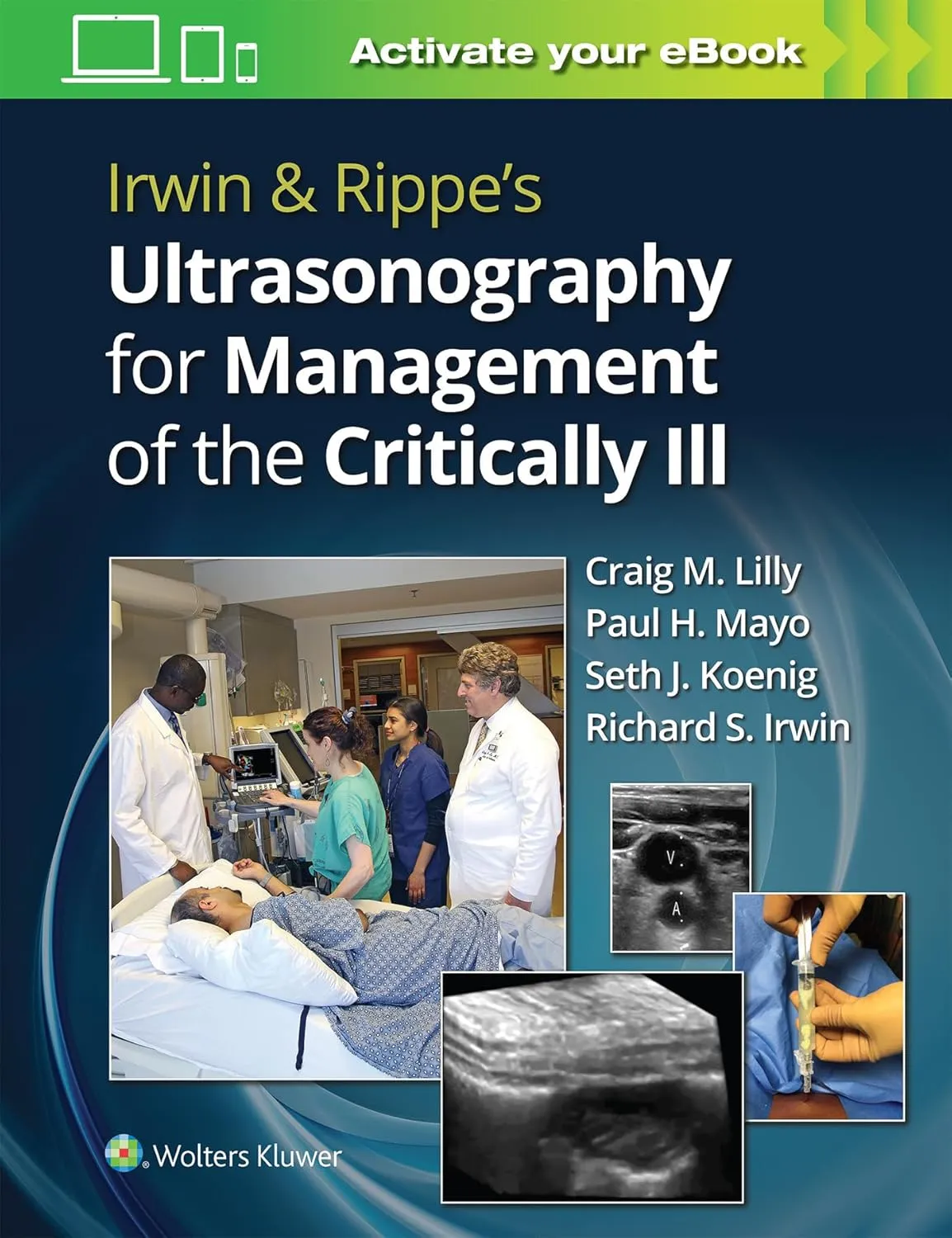 Irwin And Rippes Ultrasonography For Management Of The Critically Ill | Paperback