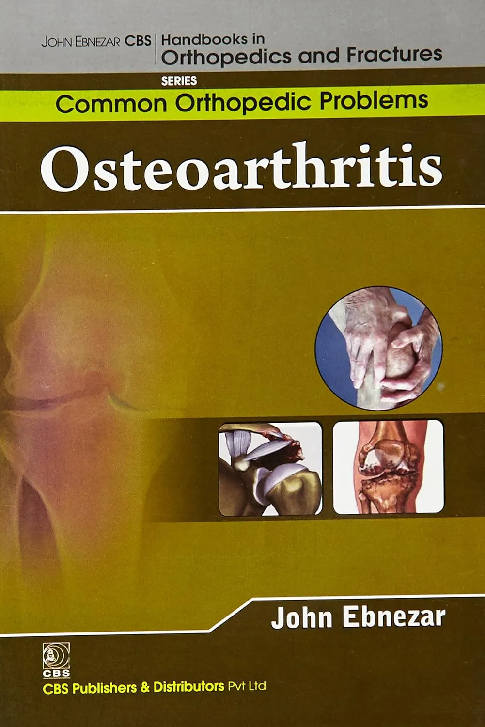 John Ebnezar CBS Handbooks in Orthopedics and Fractures Common Orthopedic Problems  Osteoarthritis