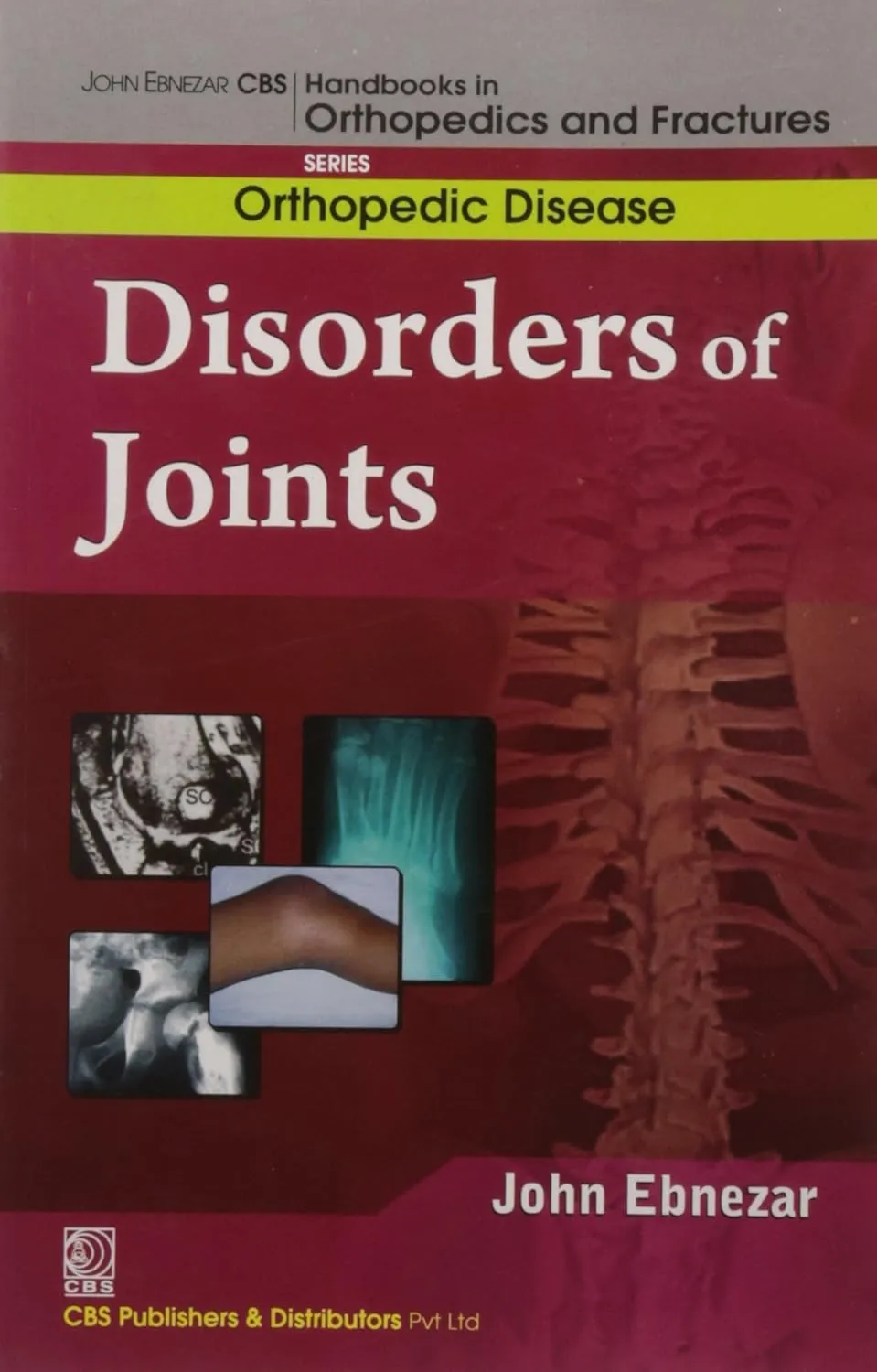 John Ebnezar CBS Handbooks in Orthopedics and Fractures Orthopedic Disease  Disorders of the Joints