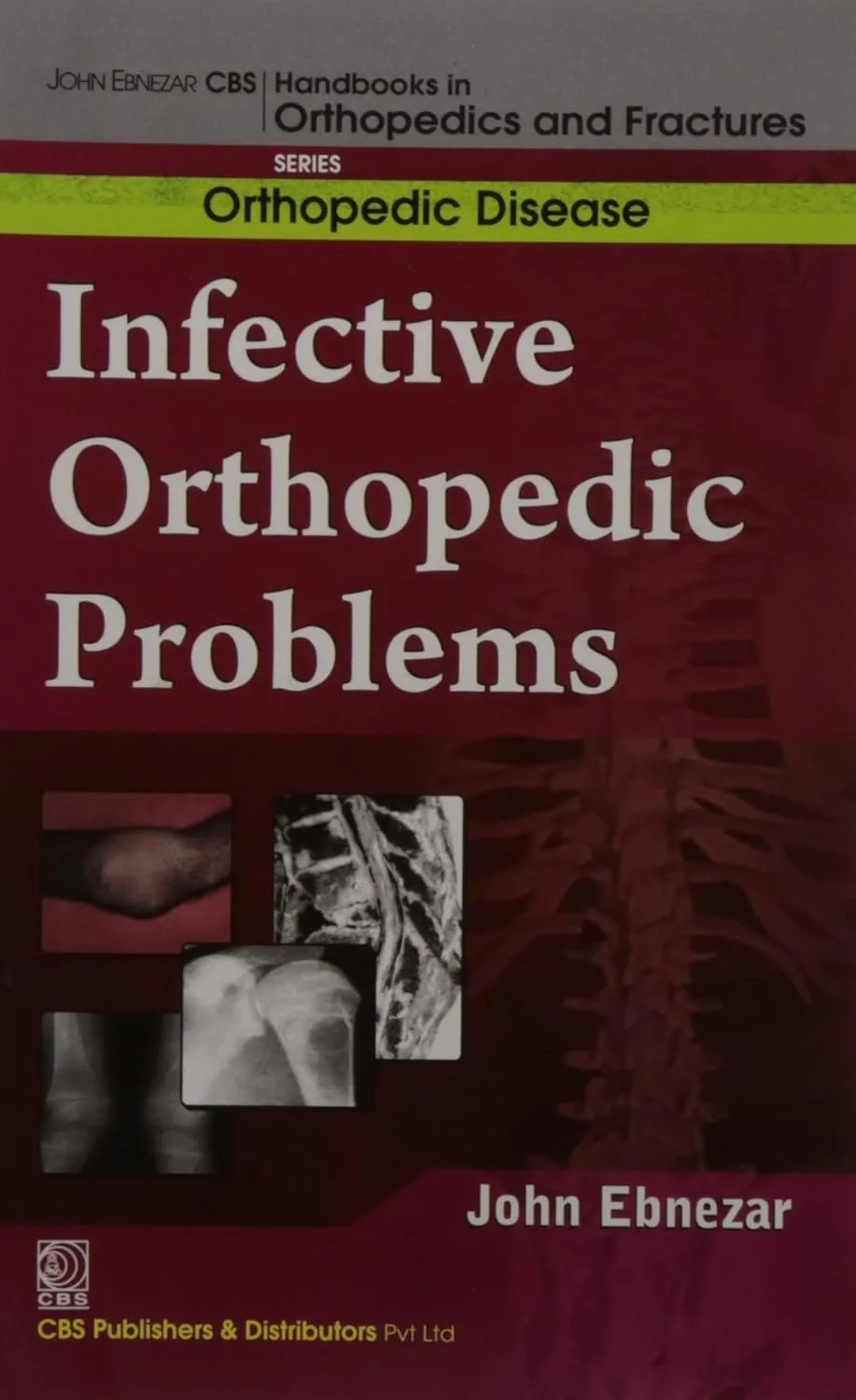 John Ebnezar CBS Handbooks in Orthopedics and Fractures Orthopedic Disease  Infective Orthopedic Problems