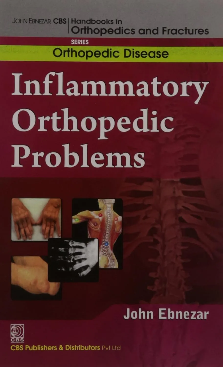 John Ebnezar CBS Handbooks in Orthopedics and Fractures Orthopedic Disease Inflammatory Orthopedic Problems