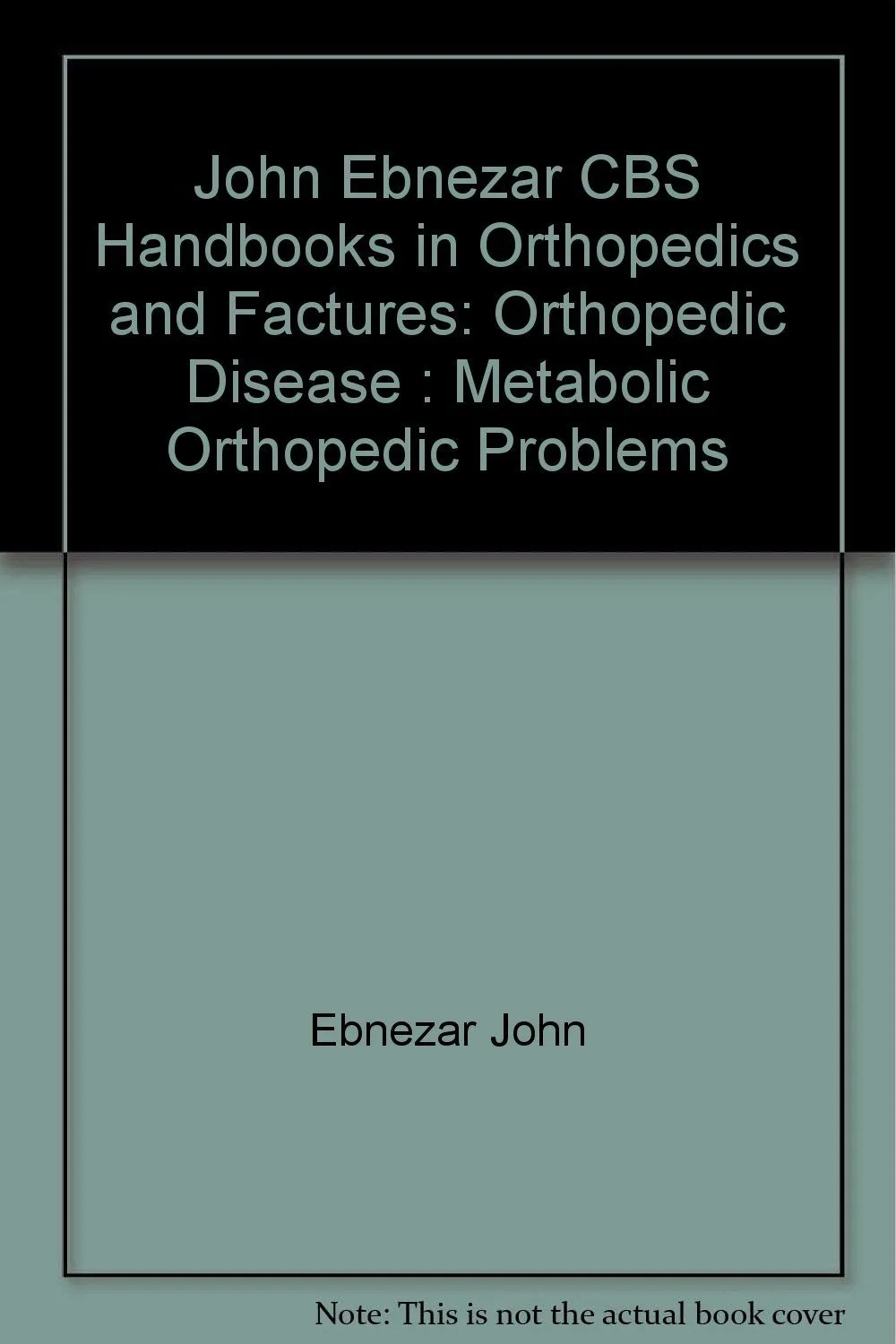John Ebnezar CBS Handbooks in Orthopedics and Fractures Orthopedic Disease  Metabolic Orthopedic Problems