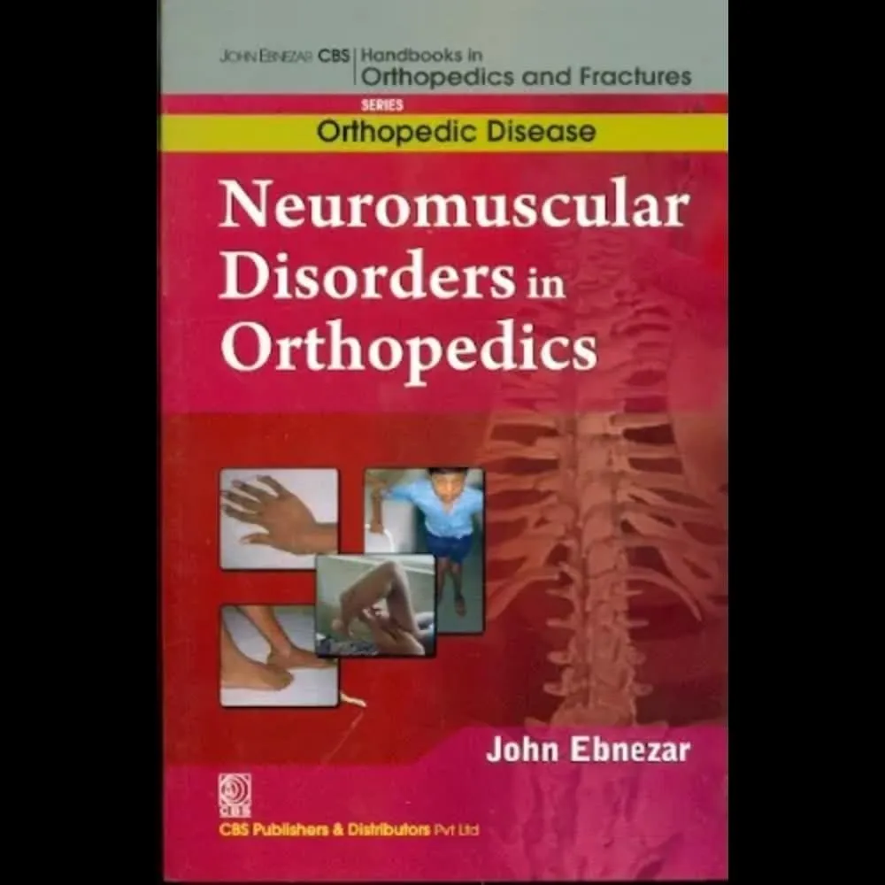 John Ebnezar CBS Handbooks in Orthopedics and Fractures Orthopedic Disease Neuromuscular Disorders in Orthopedics