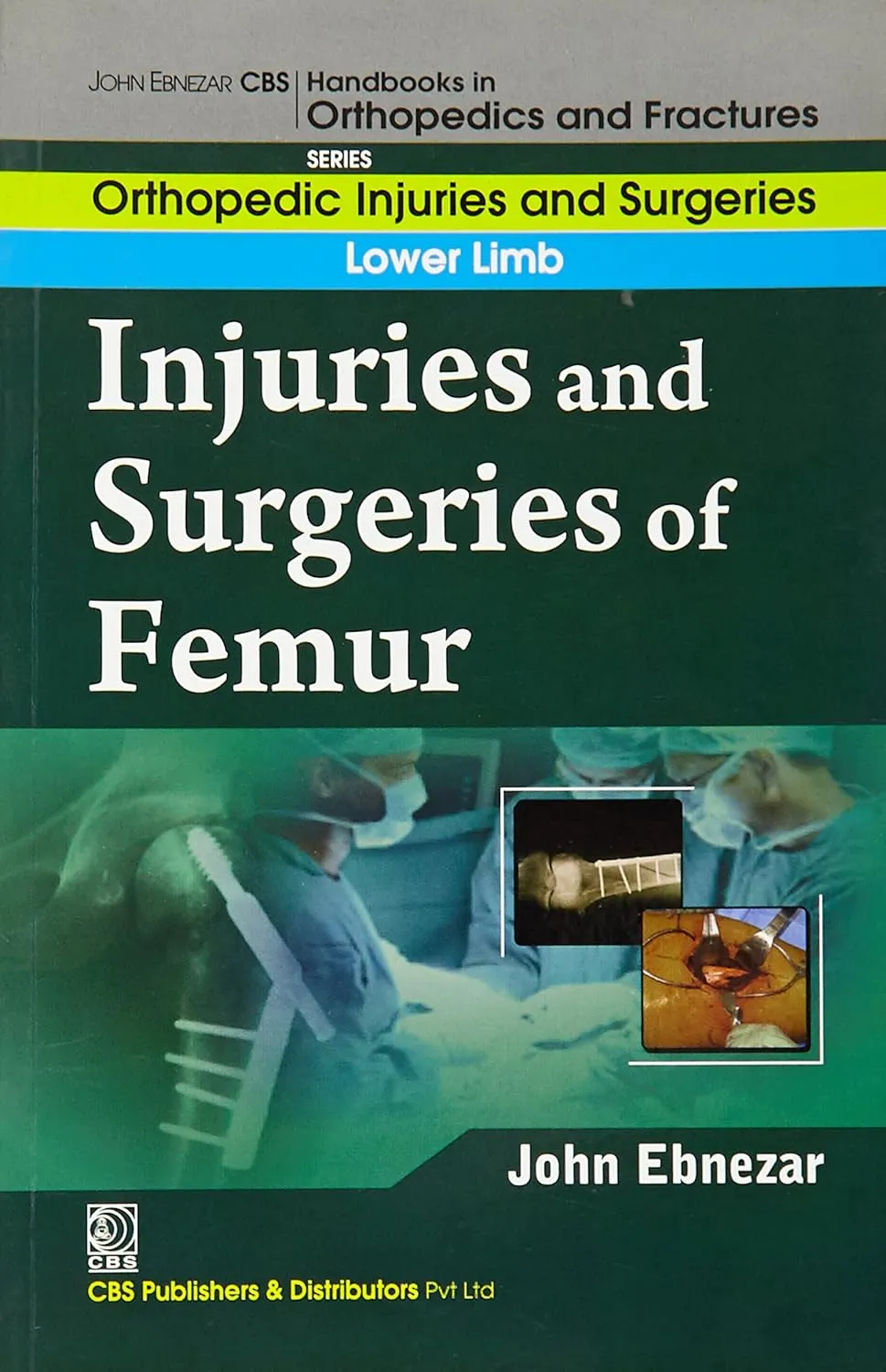 John Ebnezar CBS Handbooks in Orthopedics and Fractures Orthopedic Injuries and Surgeries  Lower Limb  Injuries and Surgeries of Femur