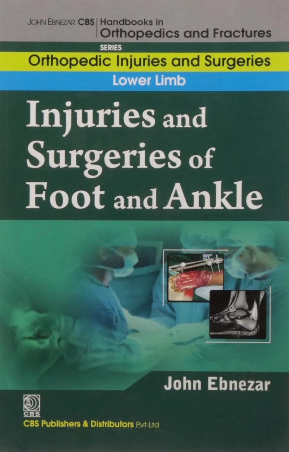 John Ebnezar CBS Handbooks in Orthopedics and Fractures Orthopedic Injuries and Surgeries  Lower Limb  Injuries and Surgeries of Foot and Ankle