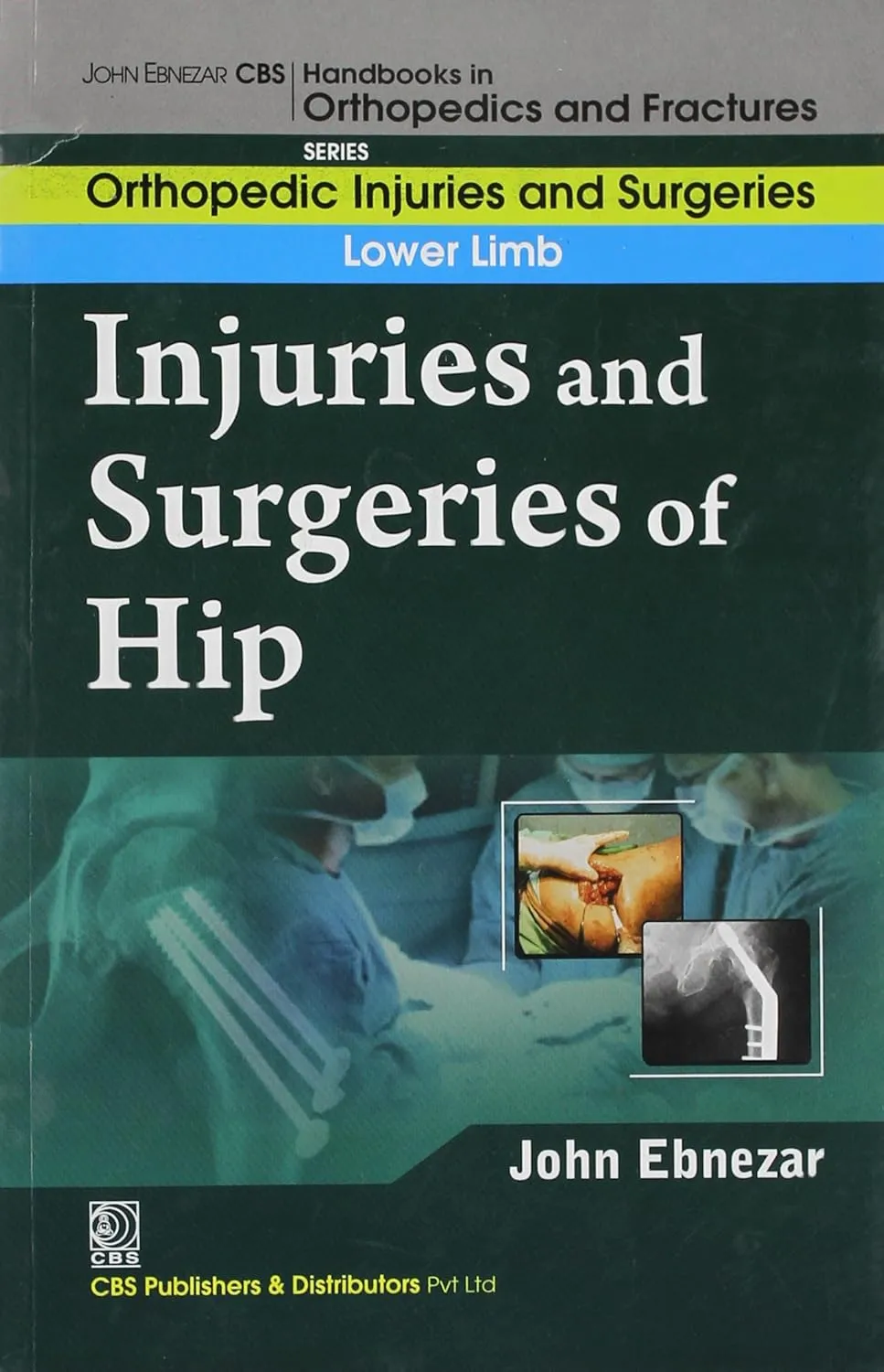 John Ebnezar CBS Handbooks in Orthopedics and Fractures Orthopedic Injuries and Surgeries Upper Limb Injuries and Surgeries of Forearm