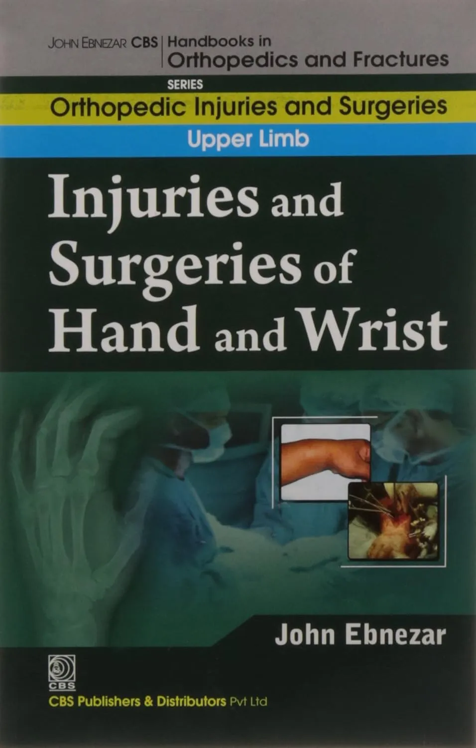 John Ebnezar CBS Handbooks in Orthopedics and Fractures Orthopedic Injuries and Surgeries Upper Limb Injuries and Surgeries of Hand and Wrist