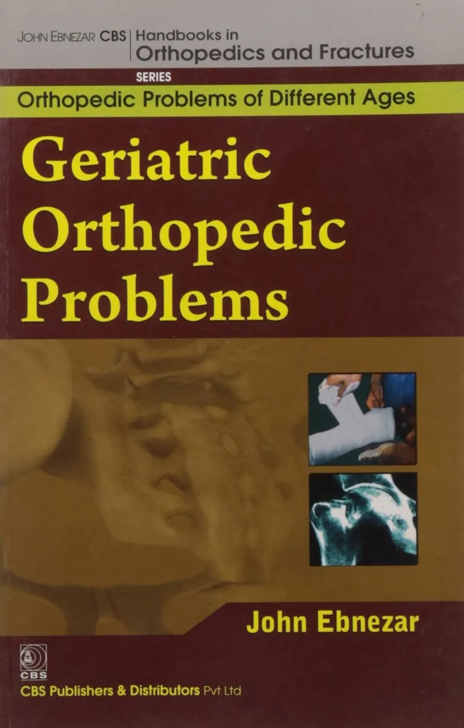 John Ebnezar CBS Handbooks in Orthopedics and Fractures Orthopedic Problems of Different Ages  Geriatric Orthopedic Problems