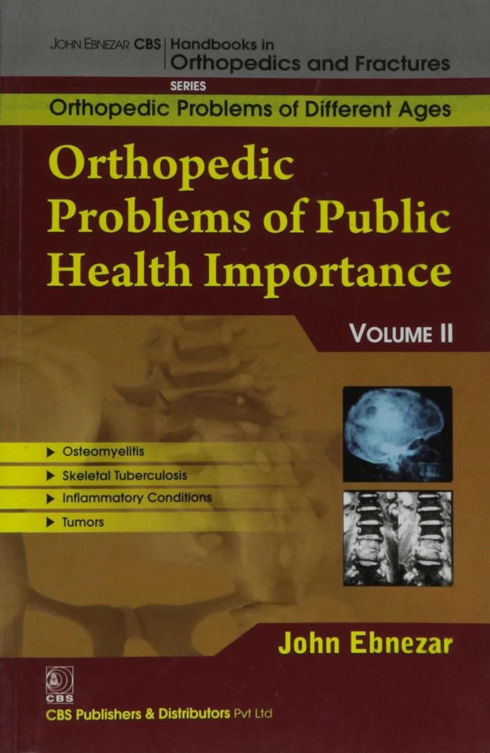 John Ebnezar CBS Handbooks in Orthopedics and Fractures Orthopedic Problems of Different Ages  Orthopedic Problems of Public Health Importance II