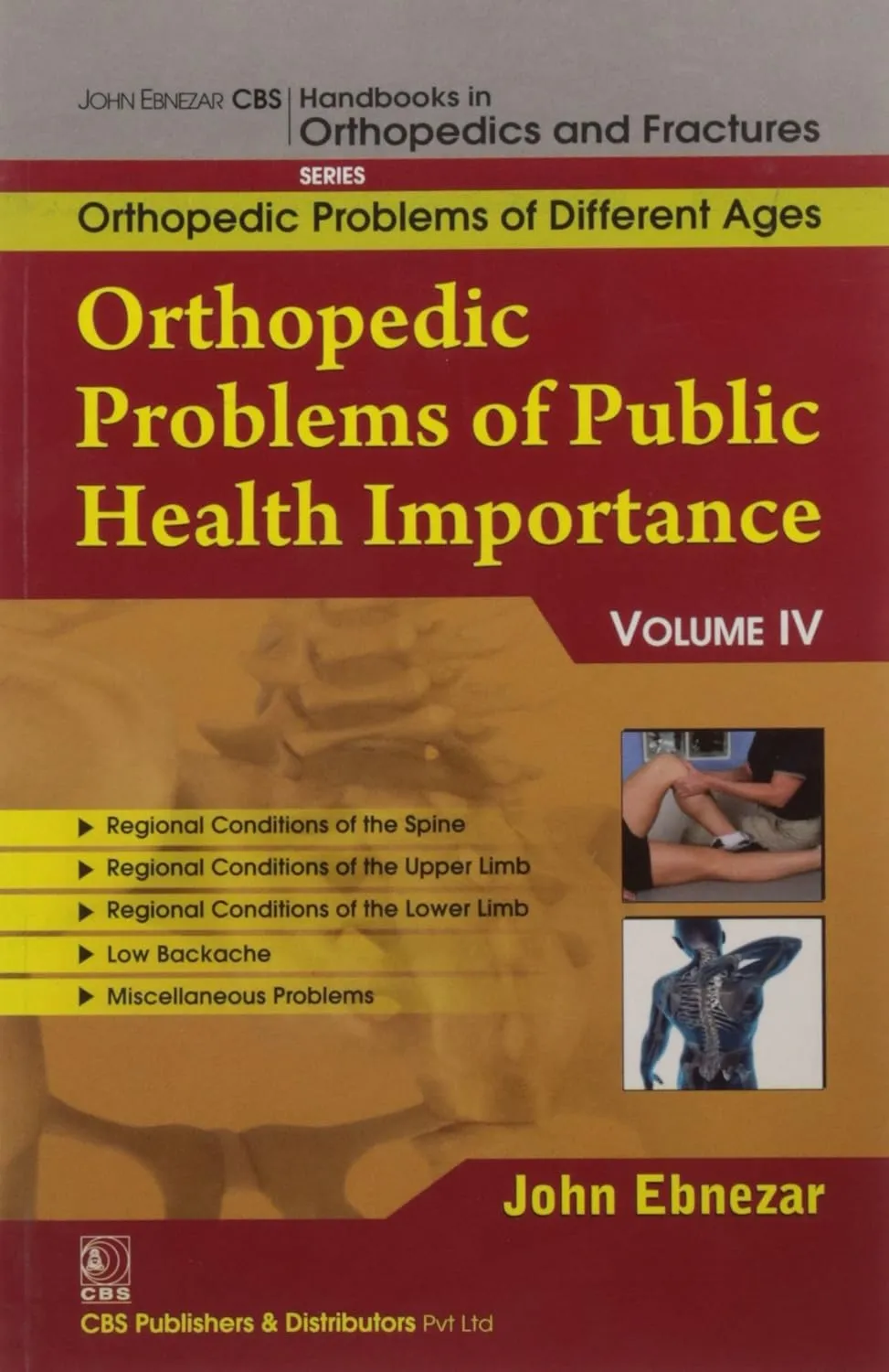 John Ebnezar CBS Handbooks in Orthopedics and Fractures Orthopedic Problems of Different Ages  Orthopedic Problems of Public Health Importance IV