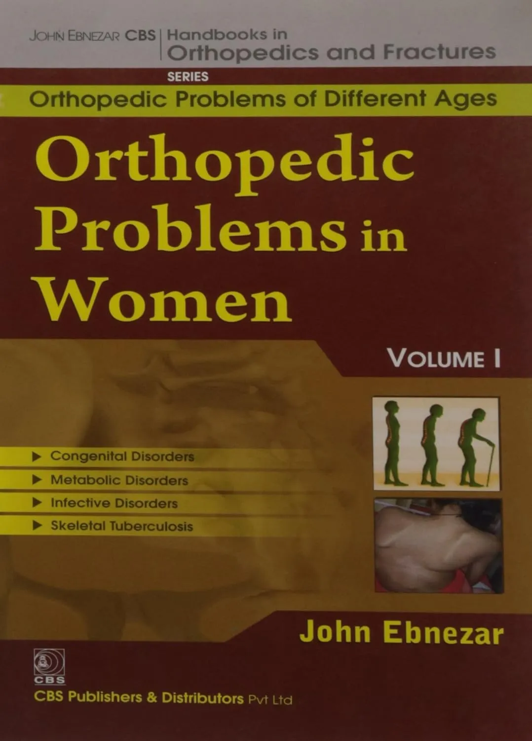 John Ebnezar CBS Handbooks in Orthopedics and Fractures Orthopedic Problems of Different Ages  Orthopedic Problems in Women I