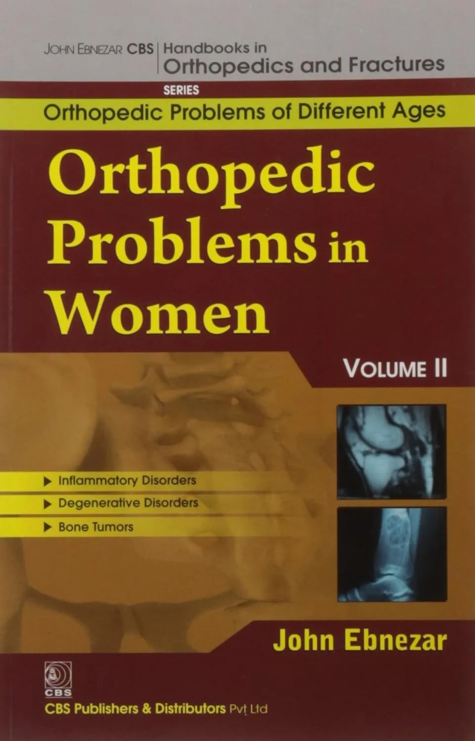 John Ebnezar CBS Handbooks in Orthopedics and Fractures Orthopedic Problems of Different Ages  Orthopedic Problems in Women II