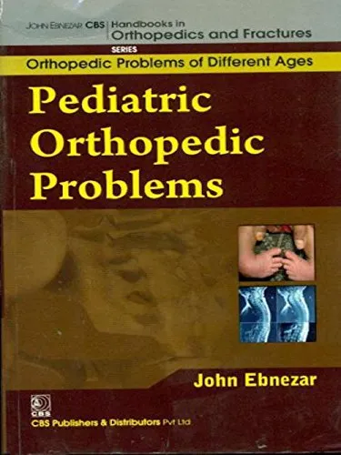 John Ebnezar CBS Handbooks in Orthopedics and Fractures Orthopedic Problems of Different Ages  Pediatric Orthopedic Problems