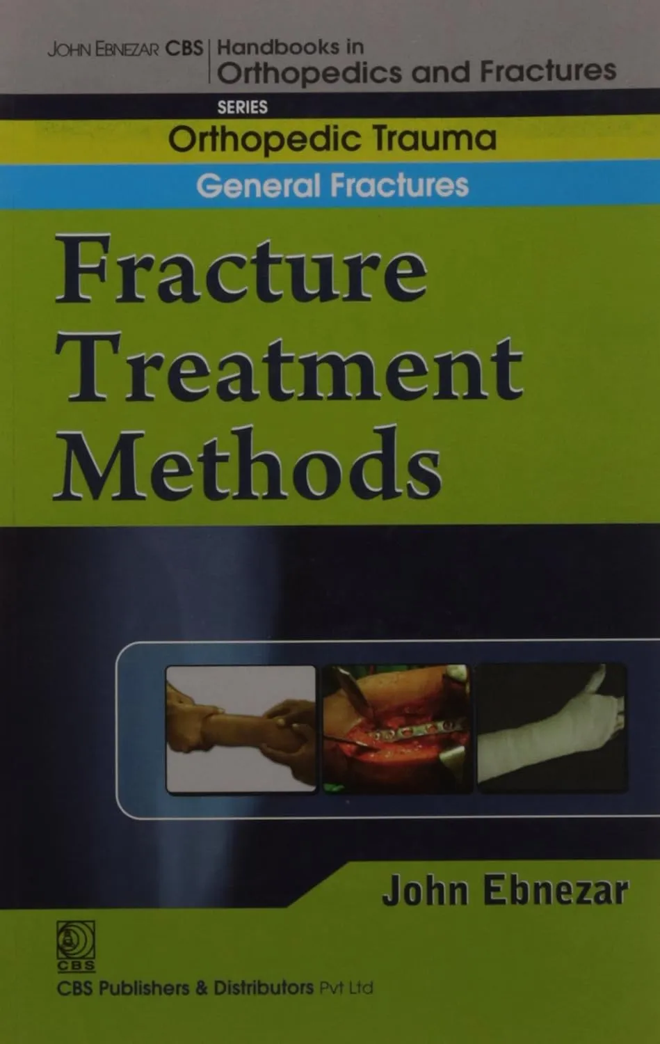 John Ebnezar CBS Handbooks in Orthopedics and Fractures Orthopedic Trauma General Fractures Fracture Treatment Methods