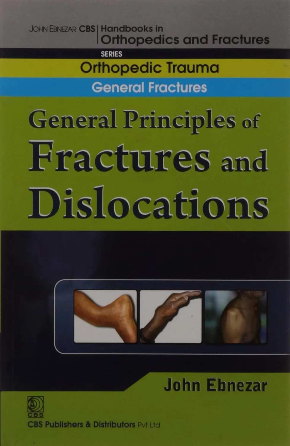 John Ebnezar CBS Handbooks in Orthopedics and Fractures Orthopedic Trauma General Fractures General Principles of Fractures and Dislocations