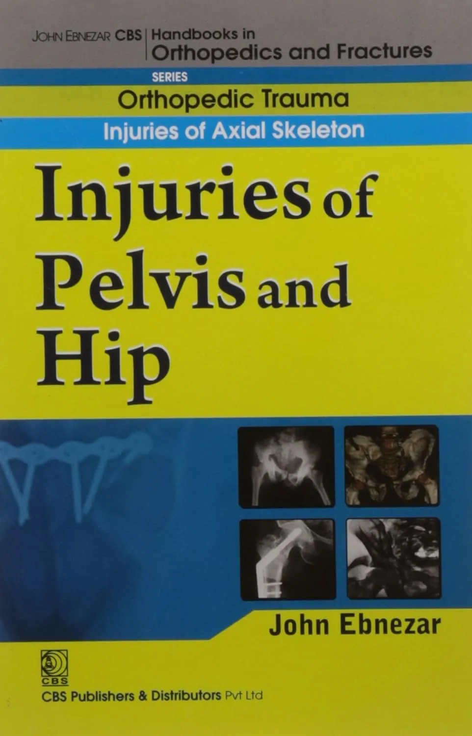 John Ebnezar CBS Handbooks in Orthopedics and Fractures Orthopedic Trauma Injuries of Axial Skeleton Injuries of Pelvis and Hip