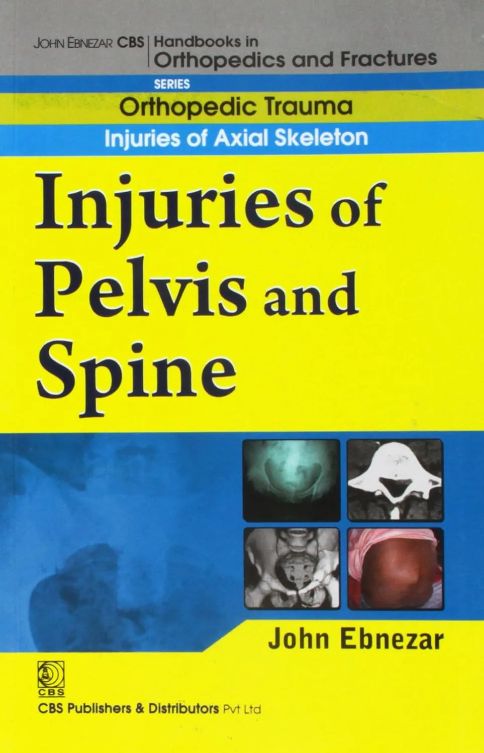 John Ebnezar CBS Handbooks in Orthopedics and Fractures Orthopedic Trauma Injuries of Axial Skeleton Injuries of Pelvis and Spine