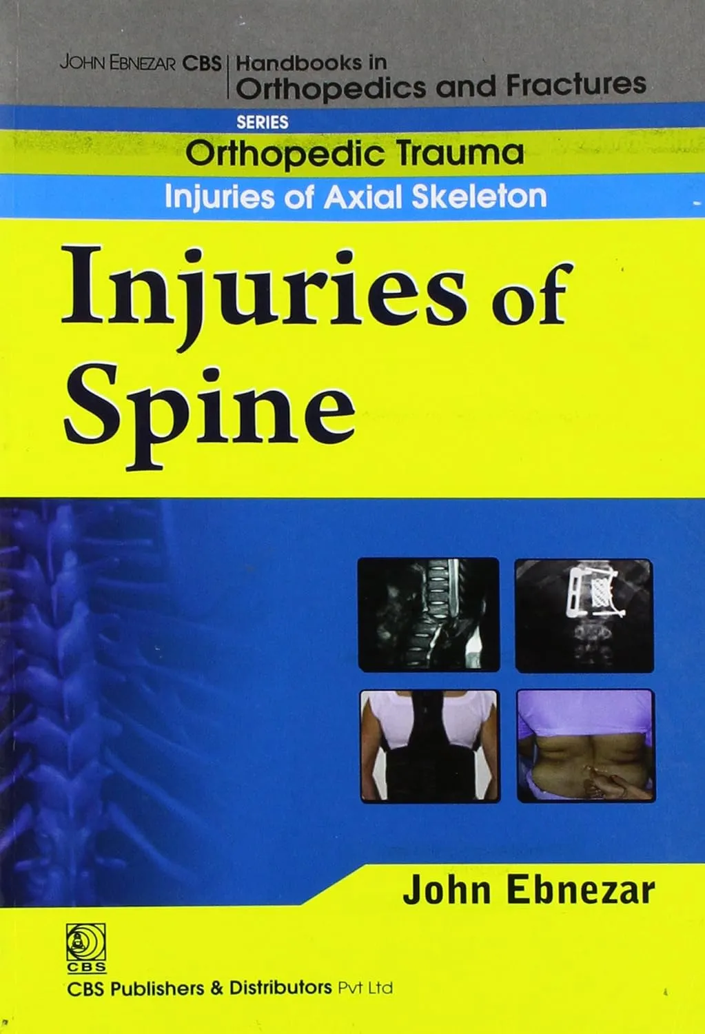 John Ebnezar CBS Handbooks in Orthopedics and Fractures Orthopedic Trauma Injuries of Axial Skeleton Injuries of Spine