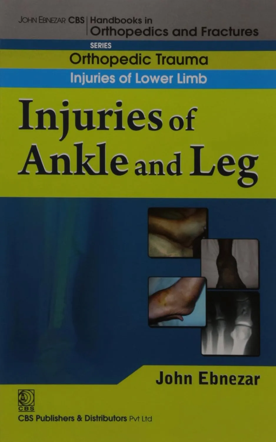 John Ebnezar CBS Handbooks in Orthopedics and Fractures Orthopedic Trauma Injuries of Lower Limb Injuries of Ankle and Leg