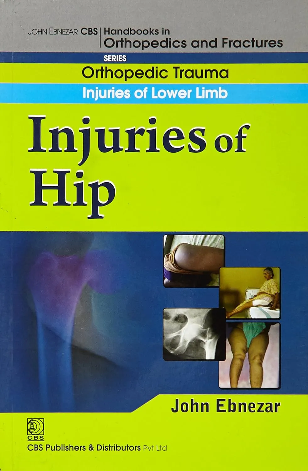 John Ebnezar CBS Handbooks in Orthopedics and Fractures Orthopedic Trauma Injuries of Lower Limb Injuries of Hip