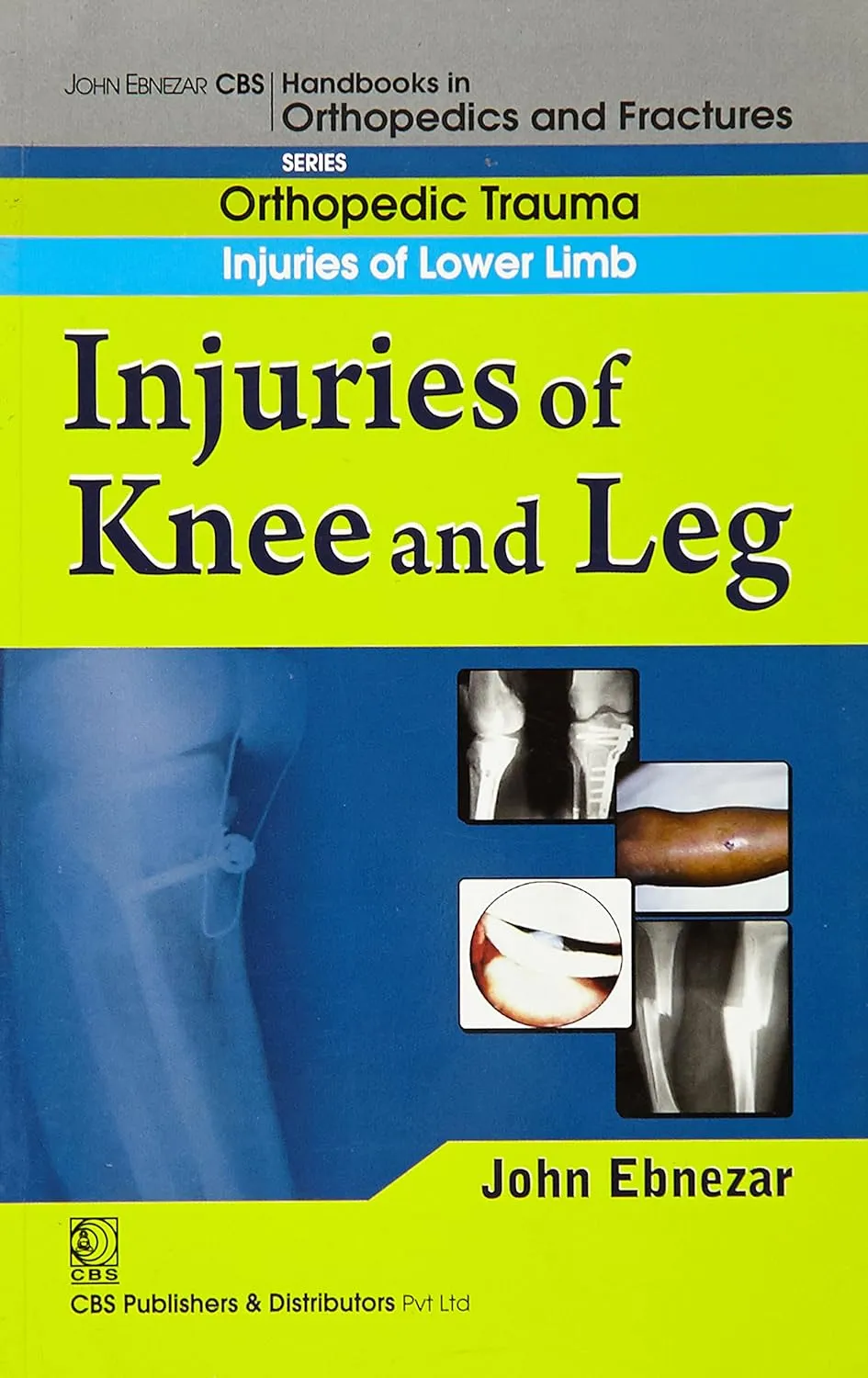 John Ebnezar CBS Handbooks in Orthopedics and Fractures Orthopedic Trauma Injuries of Lower Limb Injuries of Knee and Leg