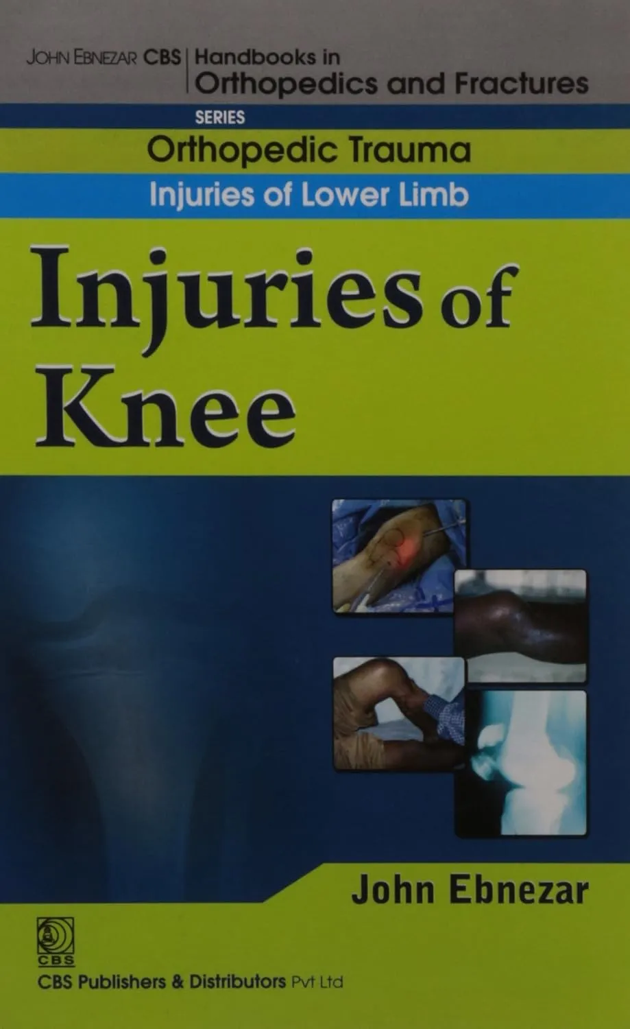 John Ebnezar CBS Handbooks in Orthopedics and Fractures Orthopedic Trauma Injuries of Lower Limb Injuries of Knee