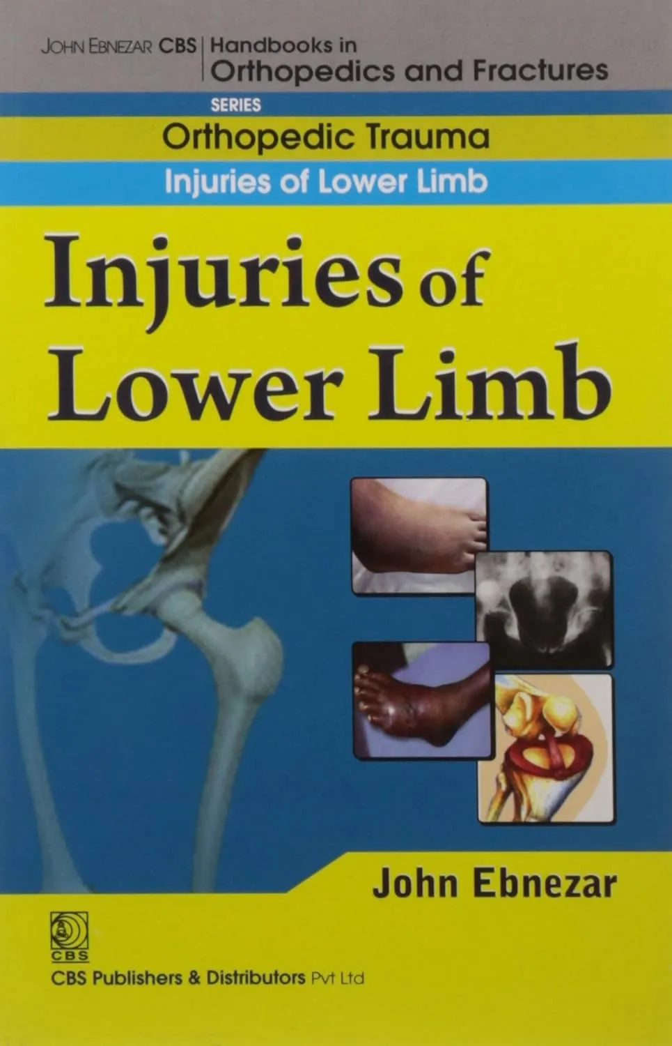 John Ebnezar CBS Handbooks in Orthopedics and Fractures Orthopedic Trauma Injuries of Lower Limb