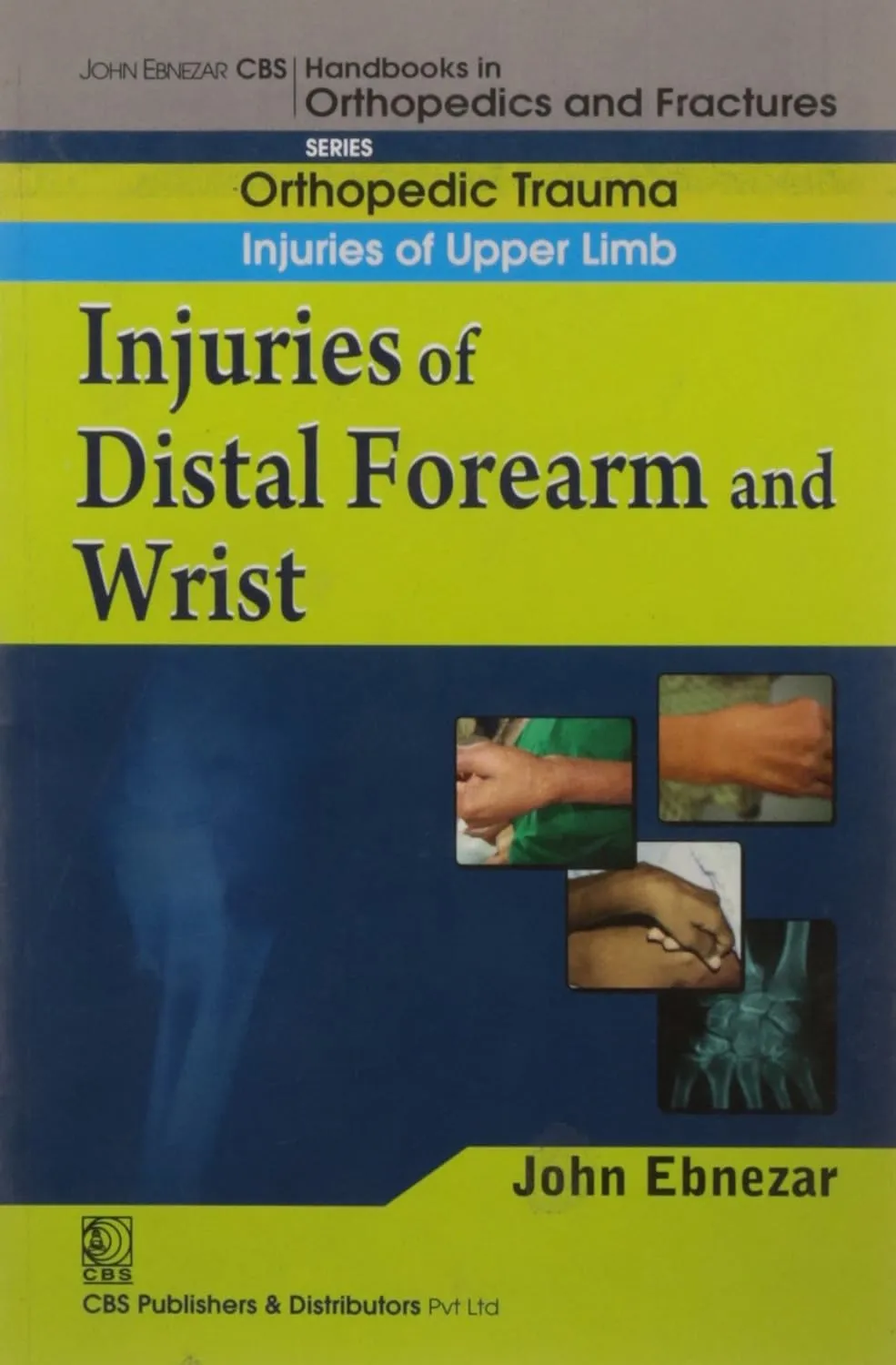 John Ebnezar CBS Handbooks in Orthopedics and Fractures Orthopedic Trauma Injuries of Upper Limb Injuries of distal forearm and wrist
