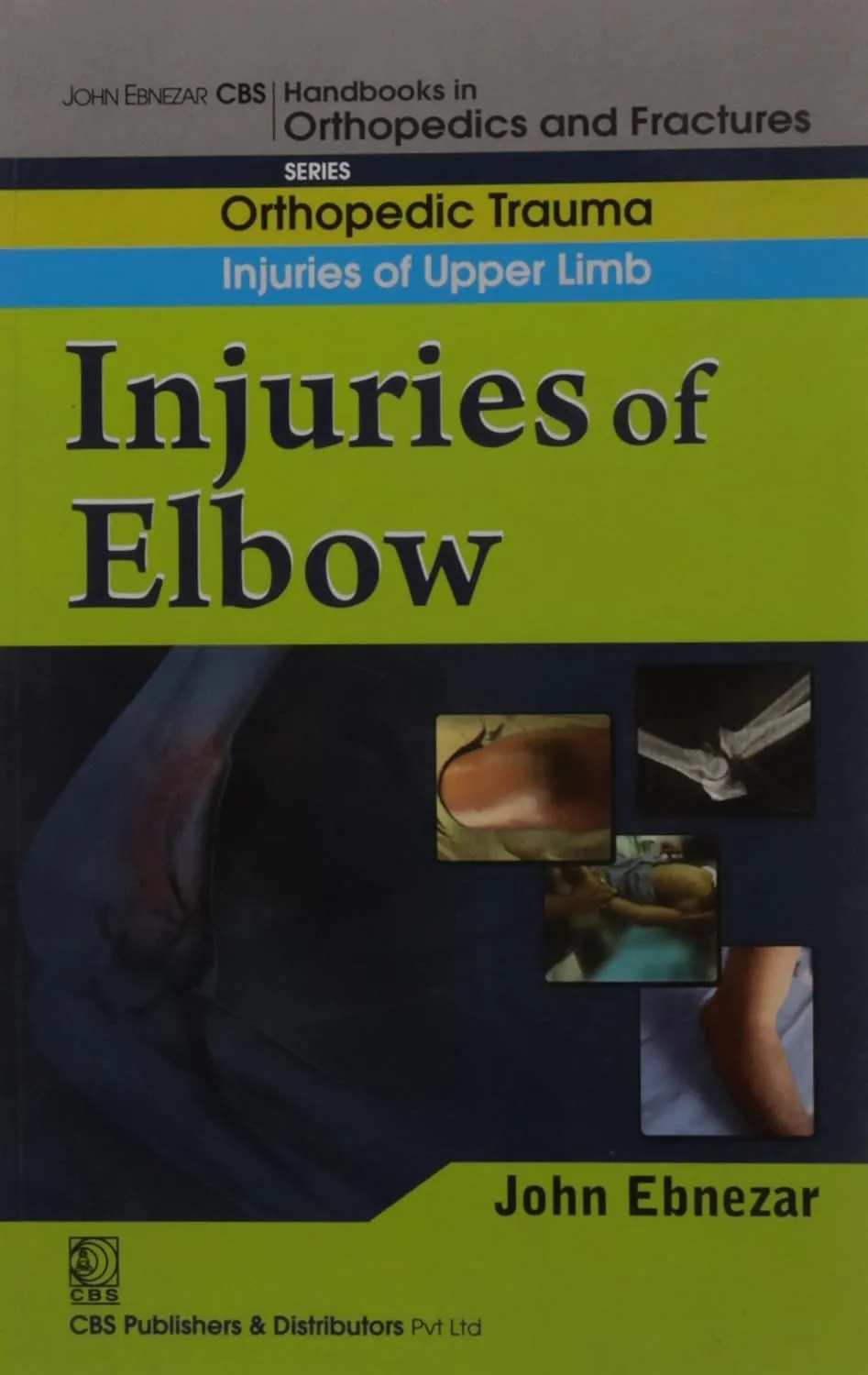John Ebnezar CBS Handbooks in Orthopedics and Fractures Orthopedic Trauma Injuries of Upper Limb Injuries of Elbow