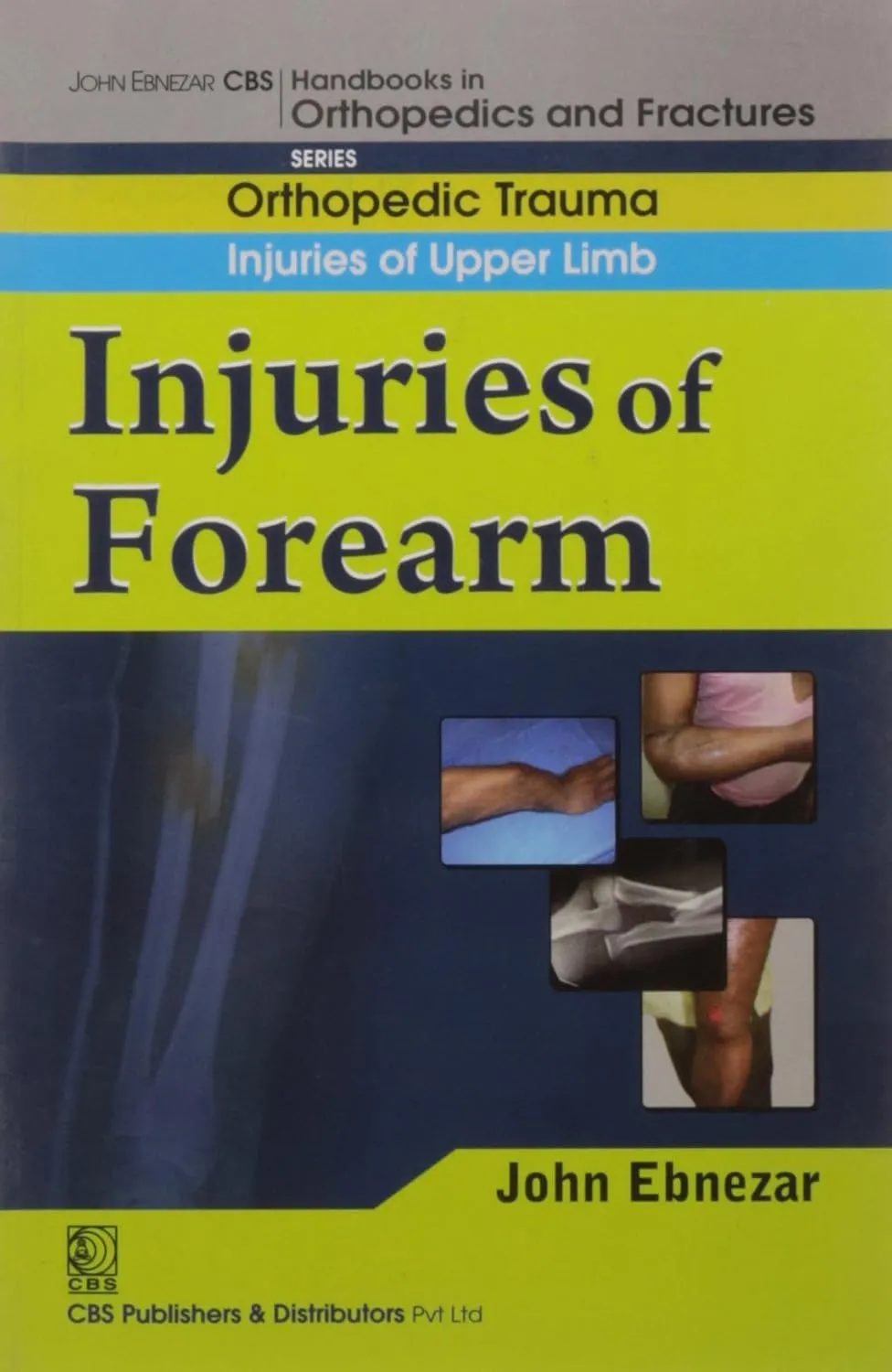 John Ebnezar CBS Handbooks in Orthopedics and Fractures Orthopedic Trauma Injuries of Upper Limb Injuries of Forearm