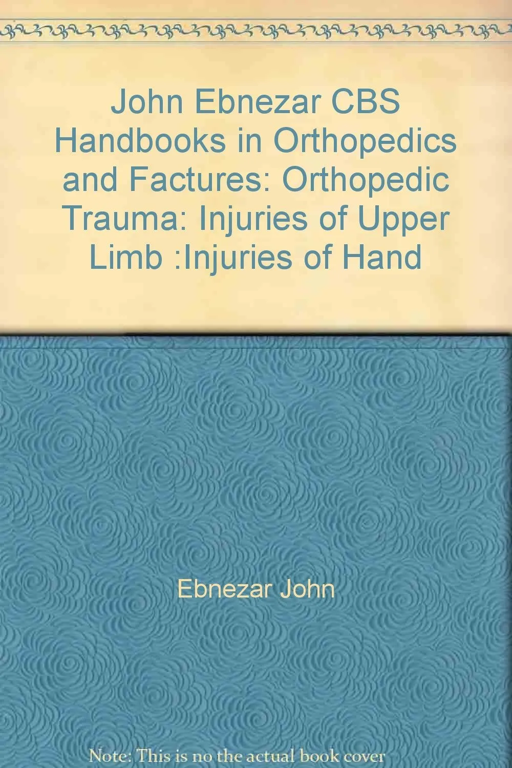 John Ebnezar CBS Handbooks in Orthopedics and Fractures Orthopedic Trauma Injuries of Upper Limb Injuries of Hand