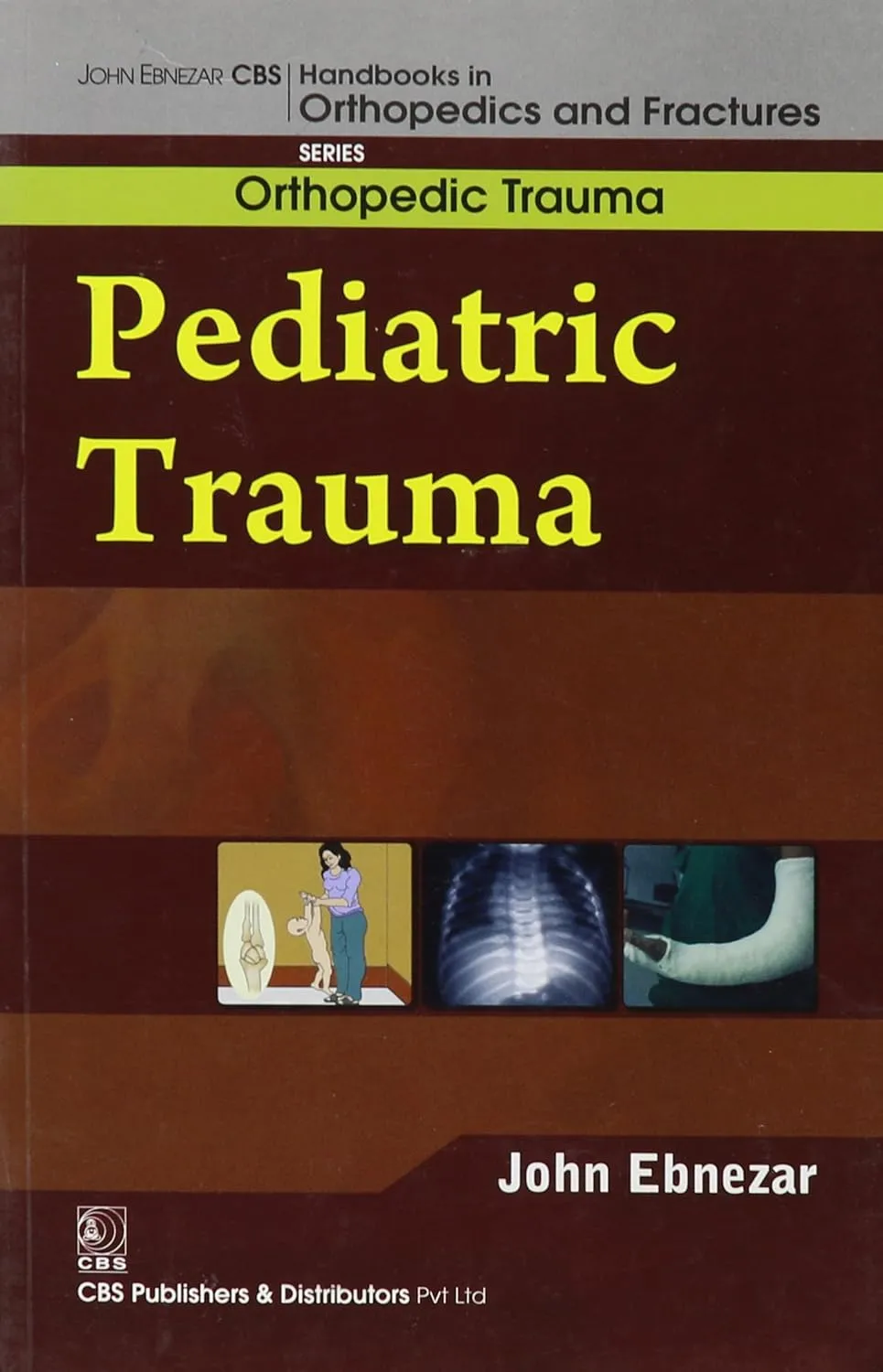 John Ebnezar CBS Handbooks in Orthopedics and Fractures Orthopedic Trauma Pediatric Trauma