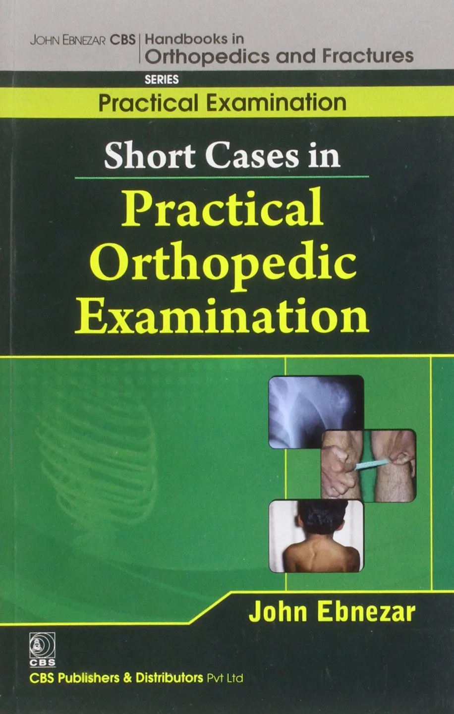 John Ebnezar CBS Handbooks in Orthopedics and Fractures Practical Examination  Short Cases in Practical Orthopedic Examinations