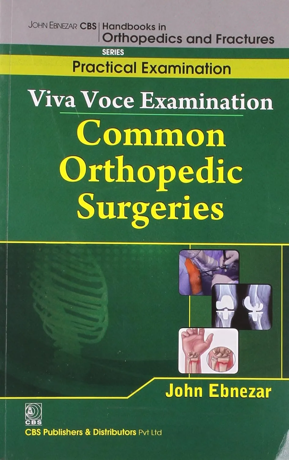 John Ebnezar CBS Handbooks in Orthopedics and Fractures Practical Examination  Viva Voce Examination Common Orthopedic Surgeries