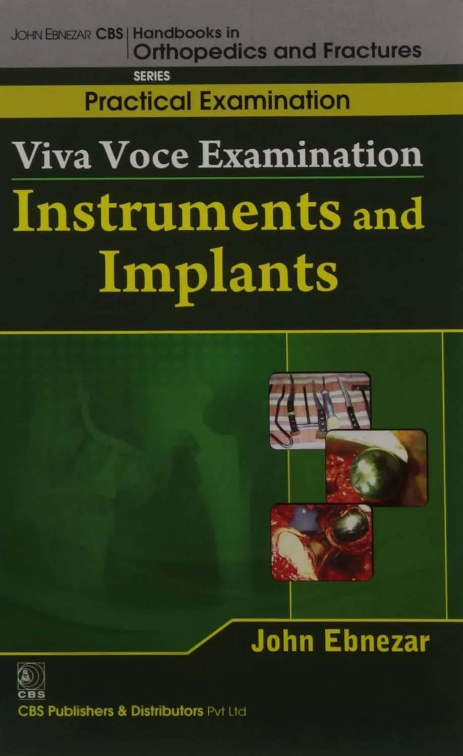 John Ebnezar CBS Handbooks in Orthopedics and Fractures Practical Examination  Viva Voce Examination Instruments and Implants