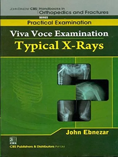 John Ebnezar CBS Handbooks in Orthopedics and Fractures Practical Examination  Viva Voce Examination Typical X-Rays