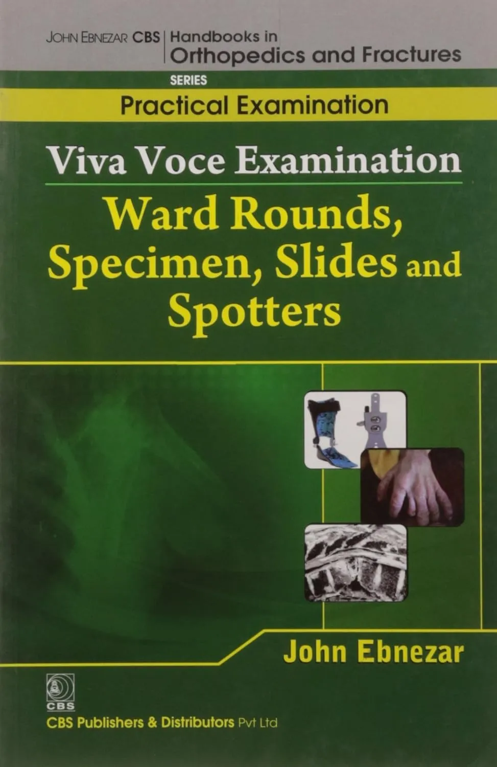 John Ebnezar CBS Handbooks in Orthopedics and Fractures Practical Examination  Viva Voce Examination Ward Rounds | Specimen | Slides | Spotters
