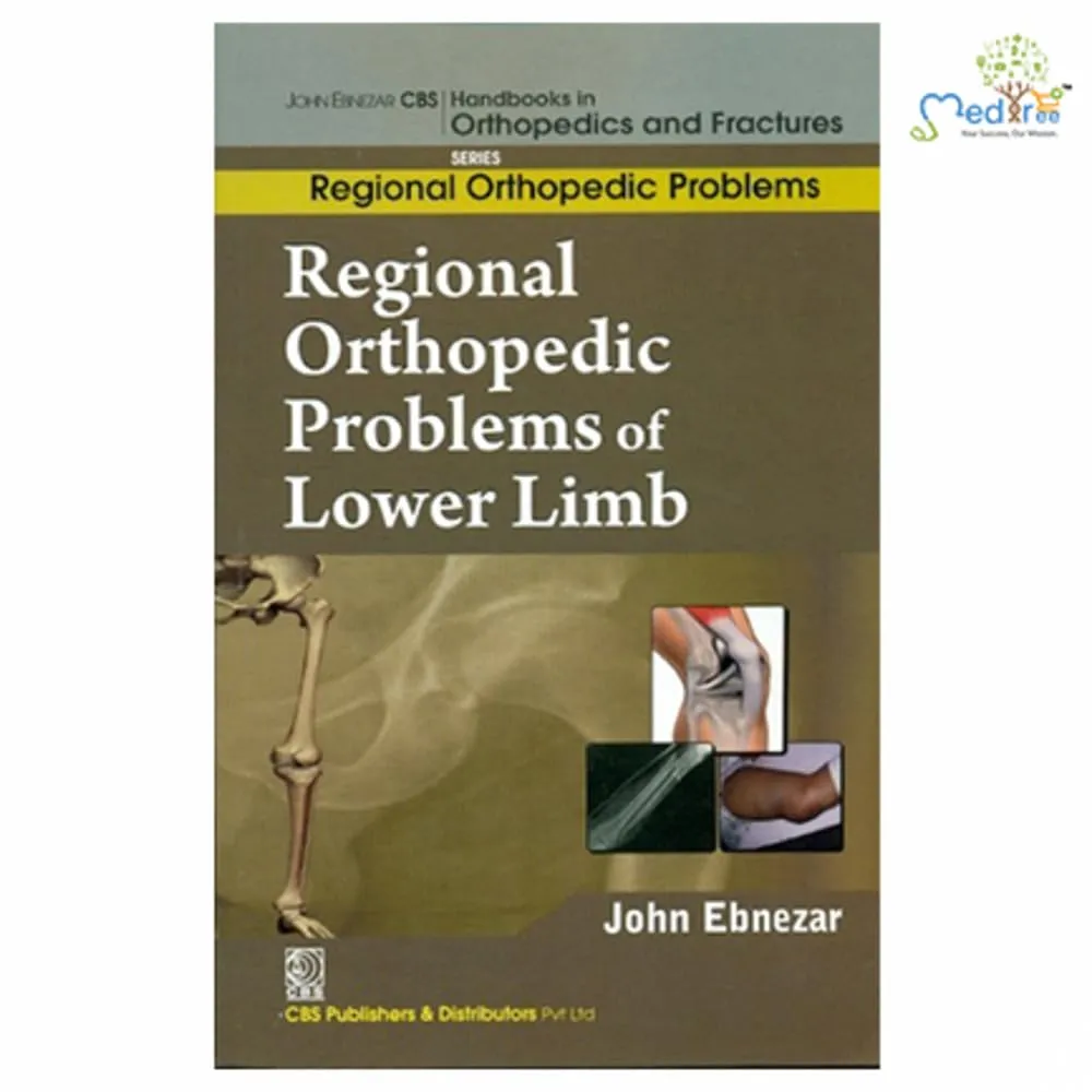 John Ebnezar CBS Handbooks in Orthopedics and Fractures Regional Orthopedic Problems  Regional Orthopedic Problems of Lower Limb