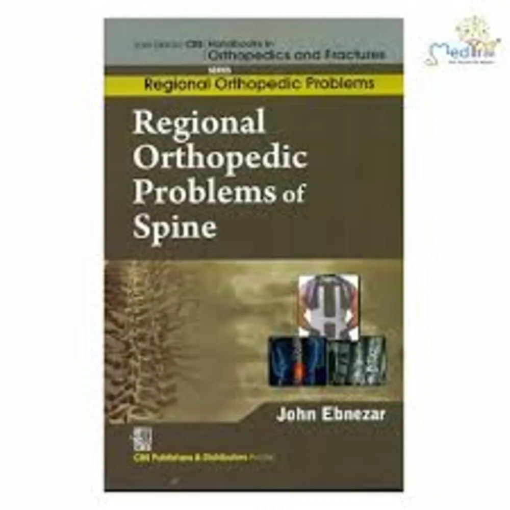 John Ebnezar CBS Handbooks in Orthopedics and Fractures Regional Orthopedic Problems  Regional Orthopedic Problems of Spine