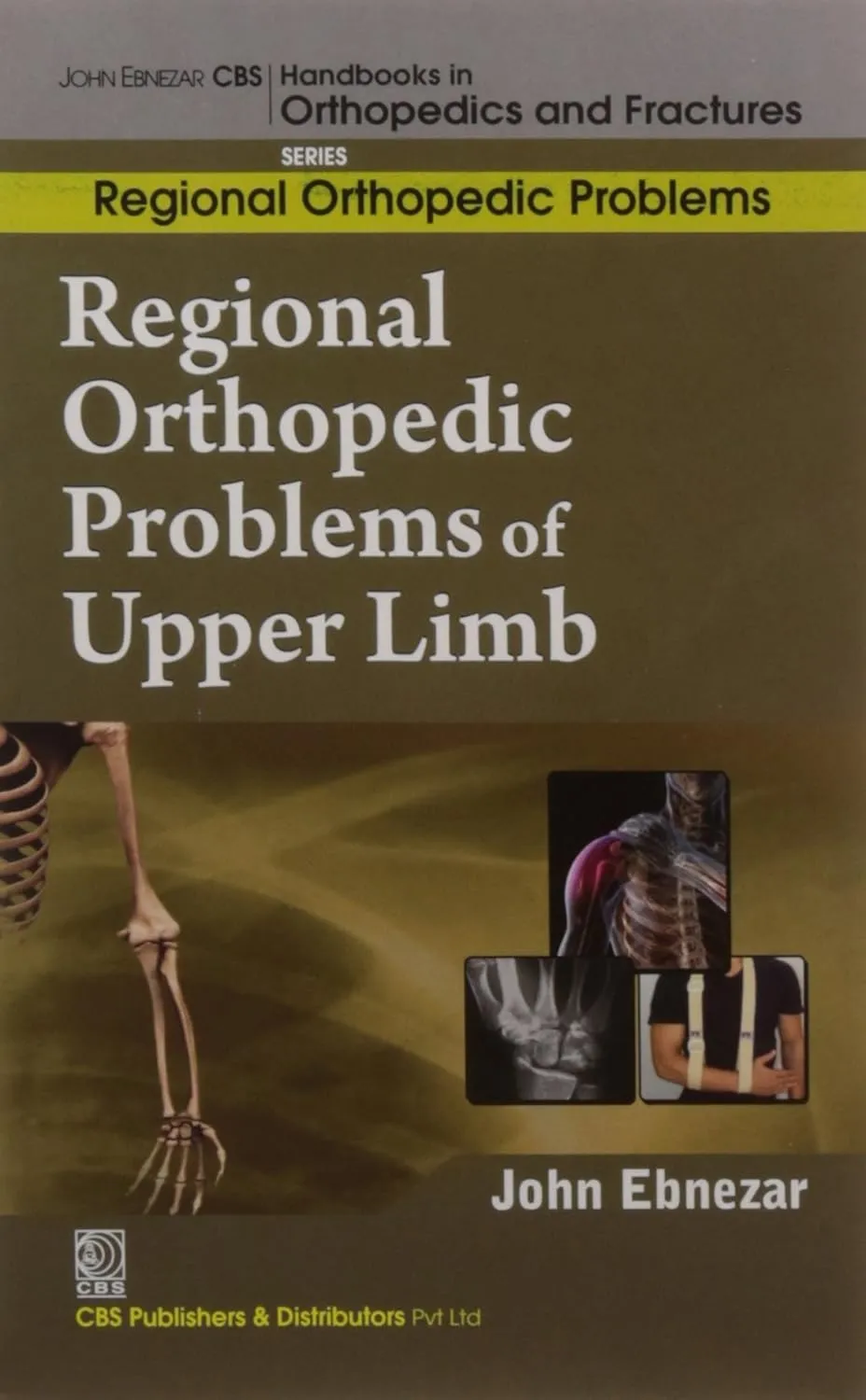John Ebnezar CBS Handbooks in Orthopedics and Fractures Regional Orthopedic Problems  Regional Orthopedic Problems of Upper Limb