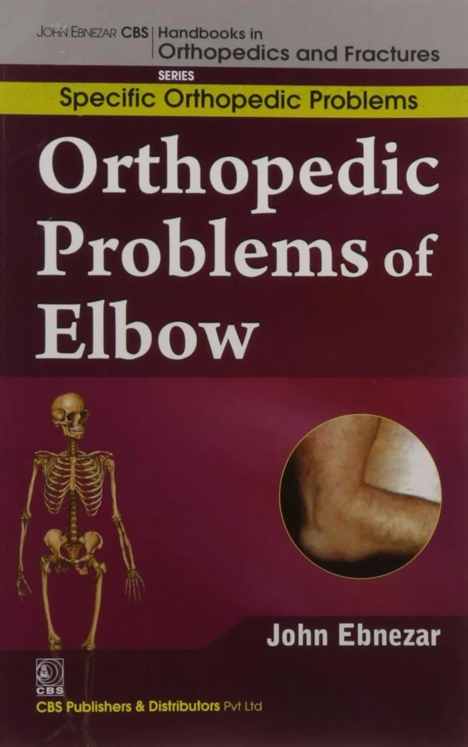 John Ebnezar CBS Handbooks in Orthopedics and Fractures Specific Orthopedic Problems  Orthopedic Problems of Elbow