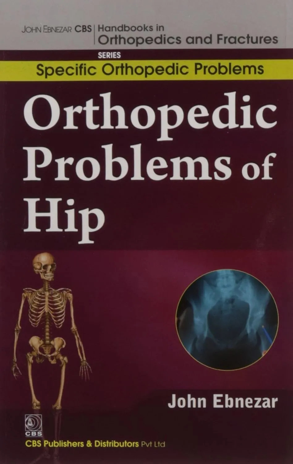 John Ebnezar CBS Handbooks in Orthopedics and Fractures Specific Orthopedic Problems Orthopedic Problems of Hip