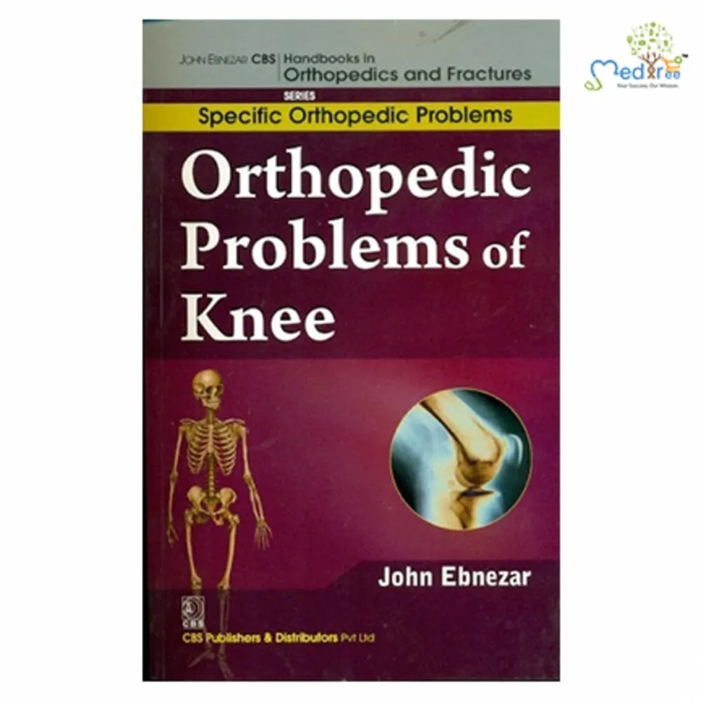 John Ebnezar CBS Handbooks in Orthopedics and Fractures Specific Orthopedic Problems Orthopedic Problems of Knee